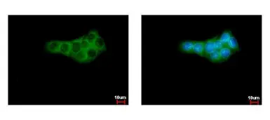 Anti-GPI antibody used in Immunocytochemistry/ Immunofluorescence (ICC/IF). GTX113203