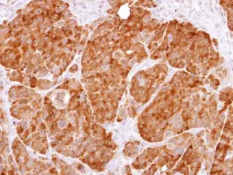 Anti-GPI antibody used in IHC (Paraffin sections) (IHC-P). GTX113203