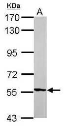 Anti-GPI antibody used in Western Blot (WB). GTX113203