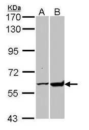 Anti-GPI antibody used in Western Blot (WB). GTX113203