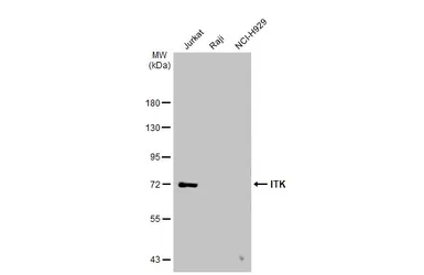 Anti-ITK antibody [N2C1], Internal used in Western Blot (WB). GTX113217