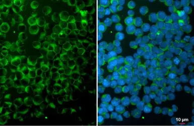 Anti-ITK antibody [N2C1], Internal used in Immunocytochemistry/ Immunofluorescence (ICC/IF). GTX113217