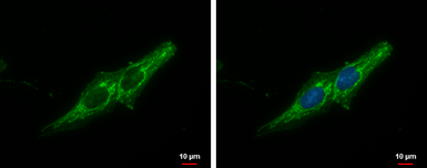 Anti-Prohibitin antibody used in Immunocytochemistry/ Immunofluorescence (ICC/IF). GTX113243