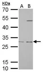 Anti-Prohibitin antibody used in Western Blot (WB). GTX113243