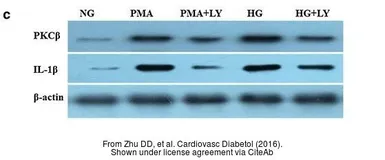 Anti-PKC beta antibody used in Western Blot (WB). GTX113252