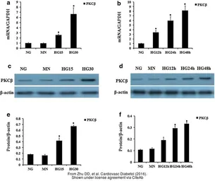 Anti-PKC beta antibody used in Western Blot (WB). GTX113252