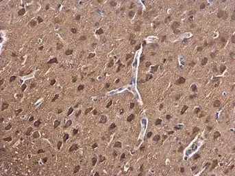 Anti-PKC beta antibody used in IHC (Paraffin sections) (IHC-P). GTX113252