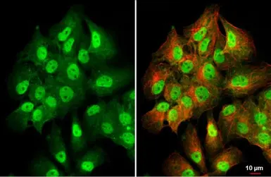 Anti-PKC beta antibody used in Immunocytochemistry/ Immunofluorescence (ICC/IF). GTX113252