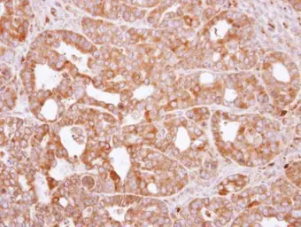 Anti-RAC2 antibody [N1C3] used in IHC (Paraffin sections) (IHC-P). GTX113262