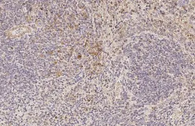 Anti-RAC2 antibody [N1C3] used in IHC (Paraffin sections) (IHC-P). GTX113262