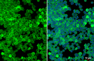 Anti-RAC2 antibody [N1C3] used in Immunocytochemistry/ Immunofluorescence (ICC/IF). GTX113262