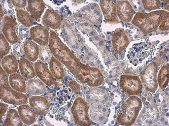 Anti-STAT6 antibody used in IHC (Paraffin sections) (IHC-P). GTX113273