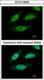 Anti-Casein Kinase 2 beta antibody used in Immunocytochemistry/ Immunofluorescence (ICC/IF). GTX113335