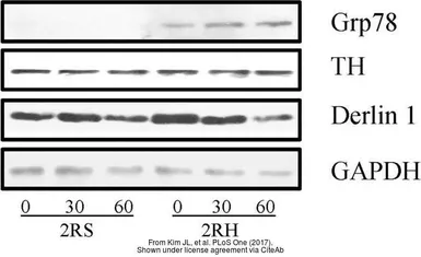 Anti-Grp78 antibody used in Western Blot (WB). GTX113340