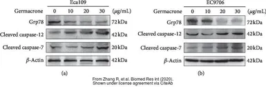 Anti-Grp78 antibody used in Western Blot (WB). GTX113340