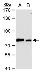 Anti-Grp78 antibody used in Western Blot (WB). GTX113340