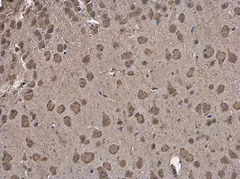 Anti-Grp78 antibody used in IHC (Paraffin sections) (IHC-P). GTX113340