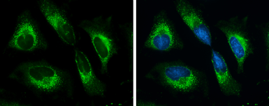 Anti-Grp78 antibody used in Immunocytochemistry/ Immunofluorescence (ICC/IF). GTX113340