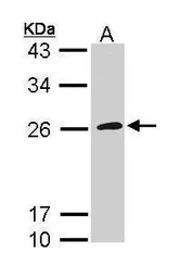 Anti-CD42c antibody [N2C2], Internal used in Western Blot (WB). GTX113355