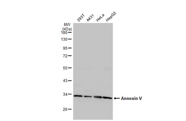 Anti-Annexin V antibody [N2C3] used in Western Blot (WB). GTX113384