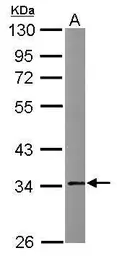 Anti-Annexin V antibody [N2C3] used in Western Blot (WB). GTX113384