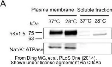 Anti-Sodium/Potassium ATPase beta 1 antibody used in Western Blot (WB). GTX113390