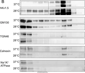 Anti-Sodium/Potassium ATPase beta 1 antibody used in Western Blot (WB). GTX113390