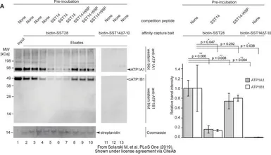 Anti-Sodium/Potassium ATPase beta 1 antibody used in Western Blot (WB). GTX113390