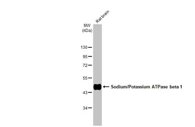 Anti-Sodium/Potassium ATPase beta 1 antibody used in Western Blot (WB). GTX113390