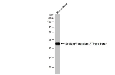 Anti-Sodium/Potassium ATPase beta 1 antibody used in Western Blot (WB). GTX113390