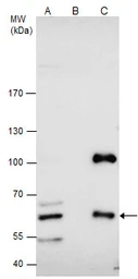 Anti-CBS antibody used in Immunoprecipitation (IP). GTX113400