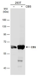 Anti-CBS antibody used in Western Blot (WB). GTX113400