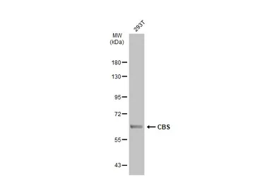 Anti-CBS antibody used in Western Blot (WB). GTX113400