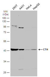 Anti-CTH antibody used in Western Blot (WB). GTX113409