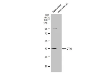 Anti-CTH antibody used in Western Blot (WB). GTX113409