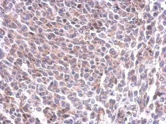 Anti-Glycogen synthase 1 antibody used in IHC (Paraffin sections) (IHC-P). GTX113453