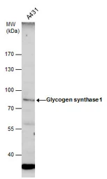 Anti-Glycogen synthase 1 antibody used in Western Blot (WB). GTX113453