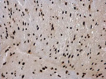 Anti-hnRNP C1/C2 antibody used in IHC (Paraffin sections) (IHC-P). GTX113463
