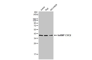 Anti-hnRNP C1/C2 antibody used in Western Blot (WB). GTX113463