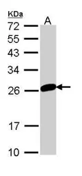 Anti-MAD2L1 antibody [N1C3] used in Western Blot (WB). GTX113489