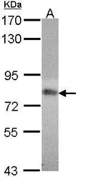 Anti-MTHFR antibody [N1N3] used in Western Blot (WB). GTX113500