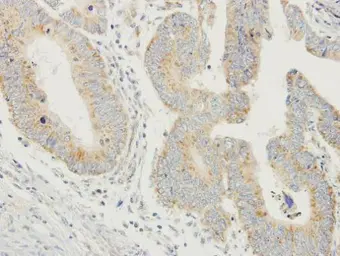 Anti-ProDynorphin antibody [N1C2] used in IHC (Paraffin sections) (IHC-P). GTX113515