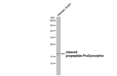 Anti-ProDynorphin antibody [N1C2] used in Western Blot (WB). GTX113515