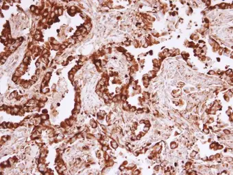 Anti-MVP/LRP antibody used in IHC (Paraffin sections) (IHC-P). GTX113601