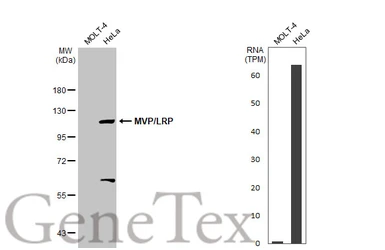 Anti-MVP/LRP antibody used in Western Blot (WB). GTX113601