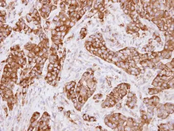 Anti-MVP/LRP antibody used in IHC (Paraffin sections) (IHC-P). GTX113601