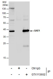 Anti-SAE1 antibody used in Immunoprecipitation (IP). GTX113602