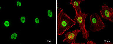 Anti-SAE1 antibody used in Immunocytochemistry/ Immunofluorescence (ICC/IF). GTX113602