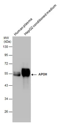 Anti-Apolipoprotein H antibody [N1C2] used in Western Blot (WB). GTX113627