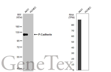 Anti-P-Cadherin antibody used in Western Blot (WB). GTX113648